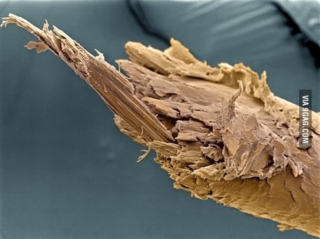 human hair under microscope