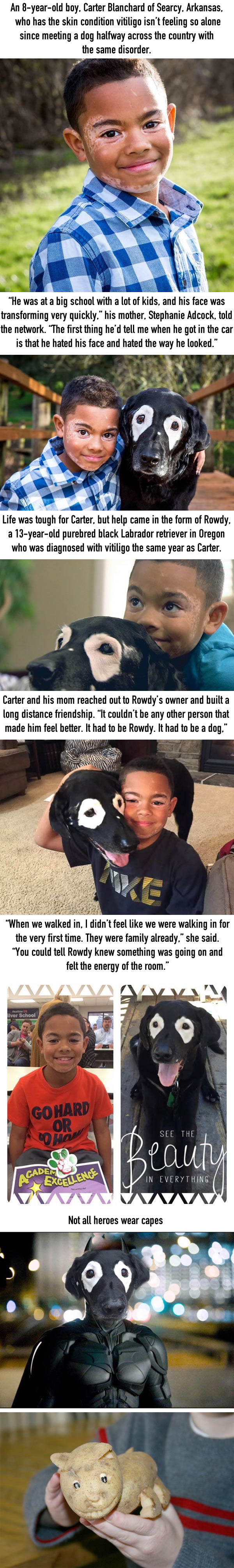 Boy with vitiligo hate himself until he finds a buddy in dog with same condition