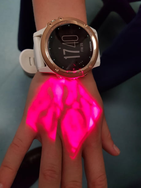 Futuristic VEIN Watch Displays Time in Beautiful Capillaries Like LED  Lights - Tuvie Design | Tech watches, Watch design, Futuristic watches
