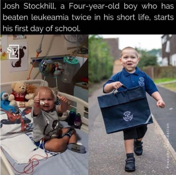 Miracles do happen and this kid just conquered Leukemia TWICE!!