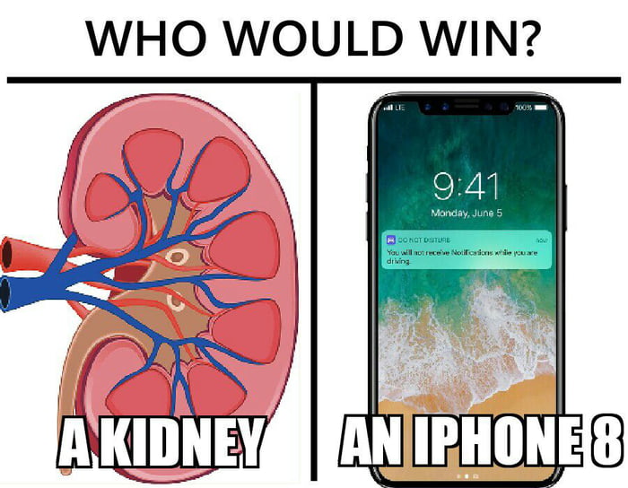 aZg1XD3_700b.jpg