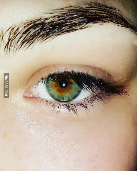 I Have Central Heterochromia Eyes And I Think That S Pretty Cool 9gag