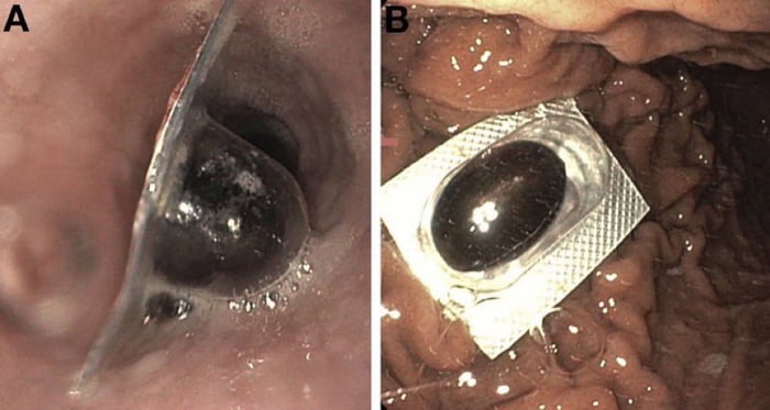Why is the medicine not taking effect? I took it just like prescribed