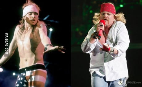 axl rose before and after