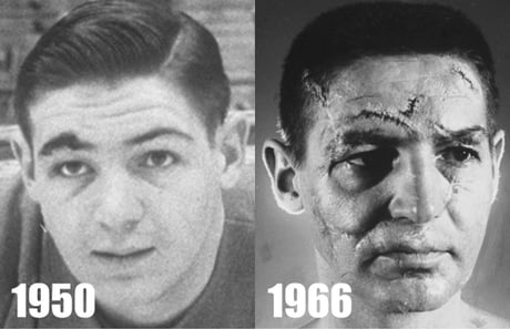 Terry Sawchuk - The face of a hockey goalie before masks became