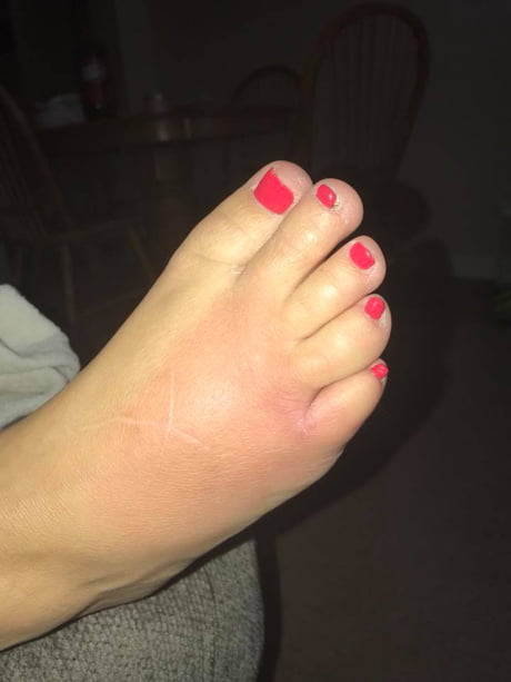 I got a pedicure today : r/WTF