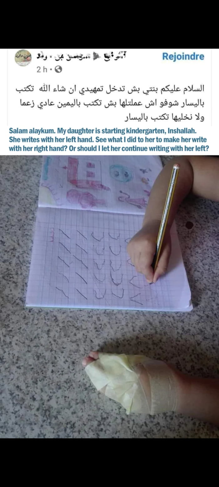 or-just-chop-it-off-9gag
