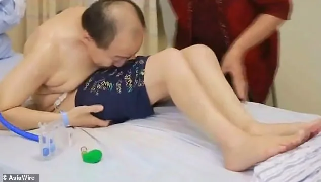 Man Folded For 28 Years Can Now Stand Straight After Risky Surgery
