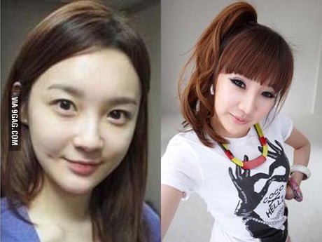 Park bom before plastic surgery