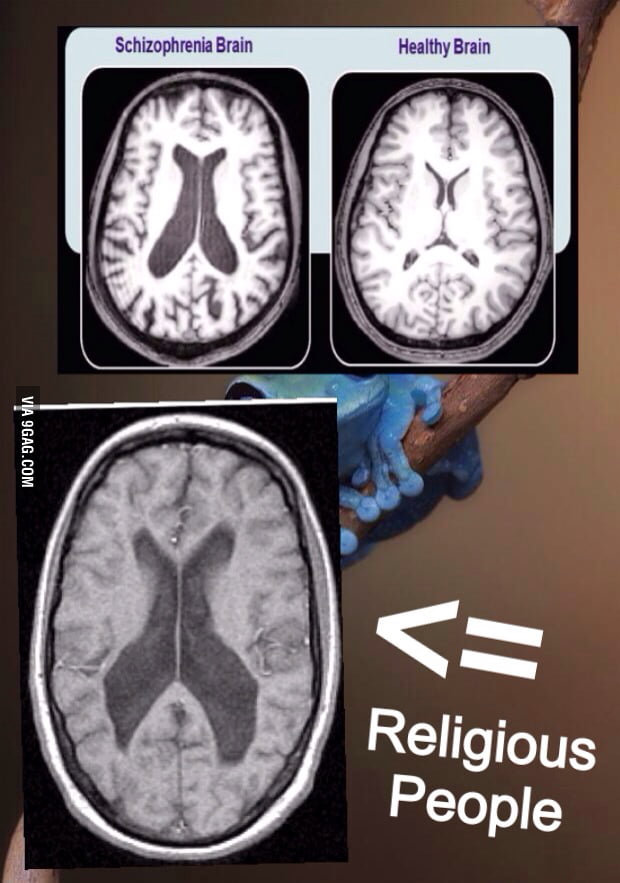 An MRI scan of a person with schizophrenia and religious people