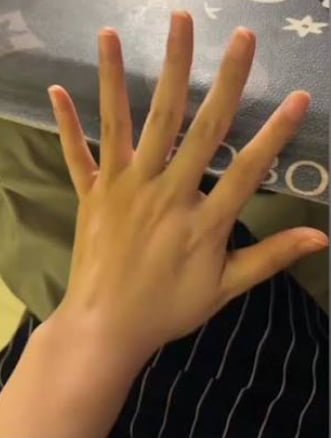 Would you date a woman with 6 fingers
