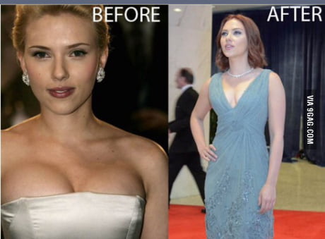 Scarlett Johansson Breast Reduction - Meme Pict