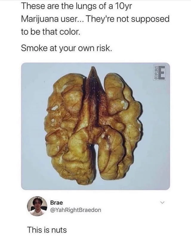 Holup, did they say 10 year old ?