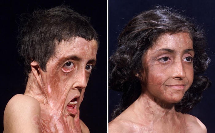 Incredible progress of modern medicine