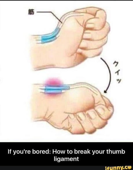 breaking your thumb ligament