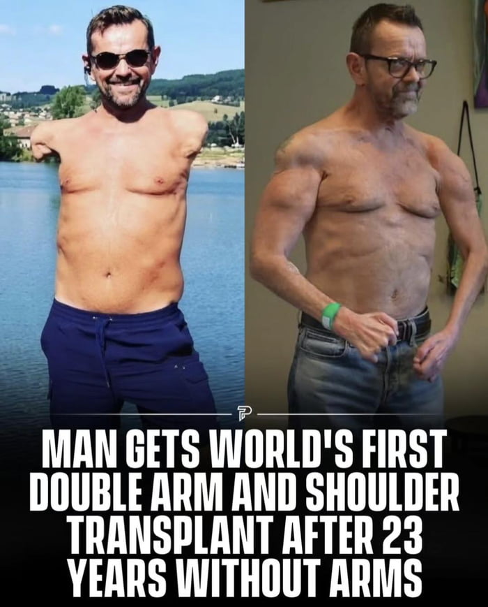 He's now losing his nose to cancer... I wish I was joking