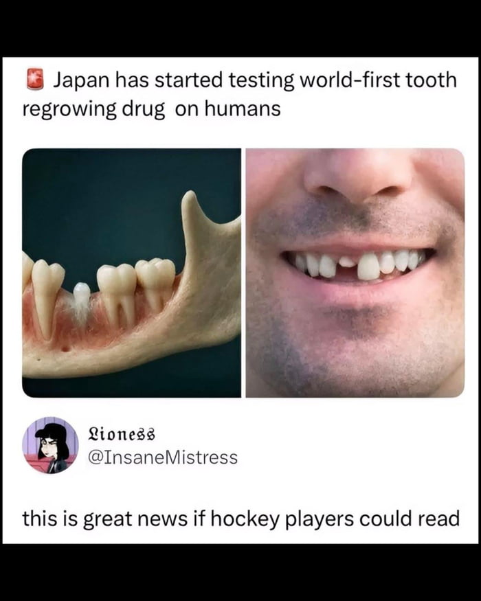 Dentists are about to lose their biggest customers