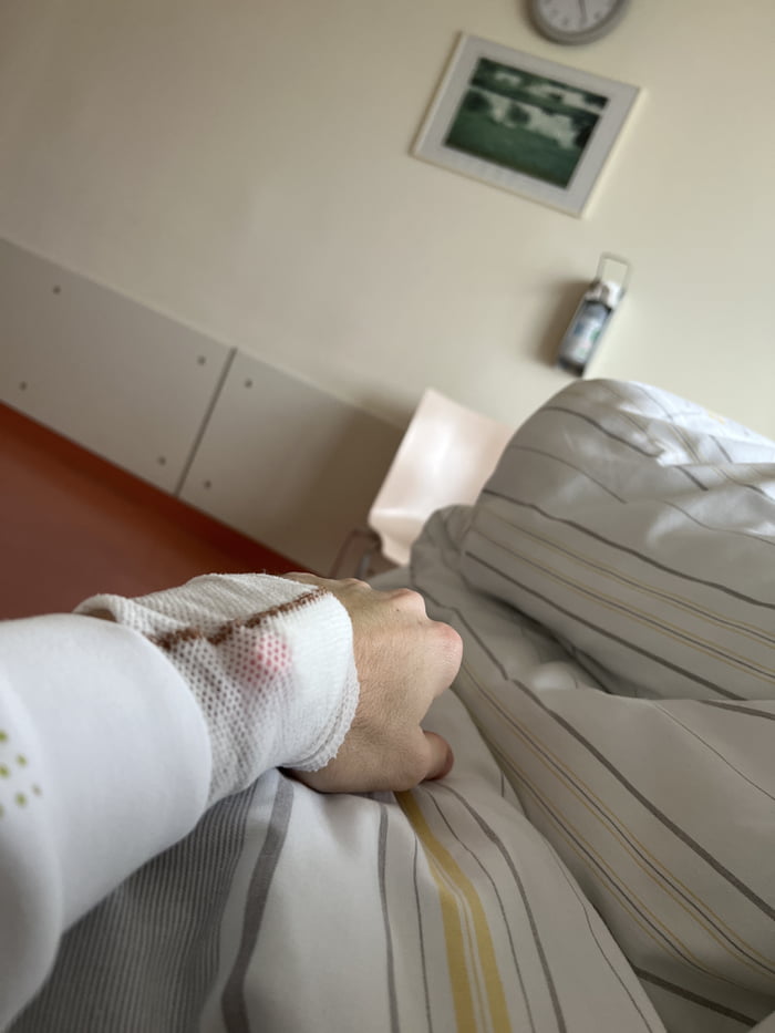 Chear me up. Woke up with 50% less Vision.